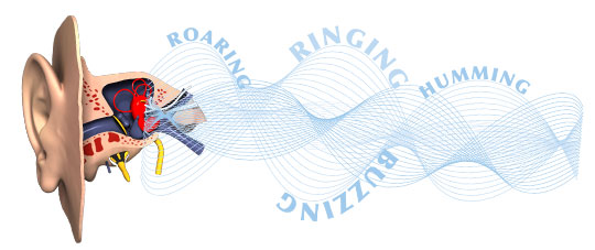 tinnitusearringing.jpg