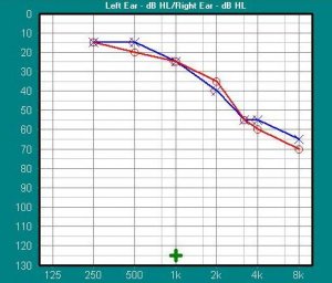 audiogram2.JPG