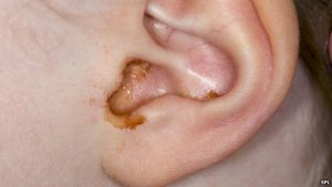e8cf06e942b331109fb4929018755688_ears3.jpg