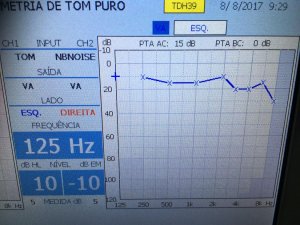 audiogram1.jpg