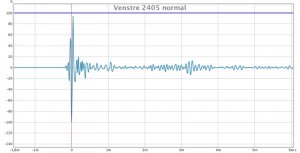 Venstre 2405 normal.jpg