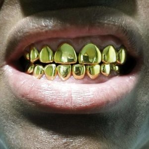 863683450_gold+teeth.jpg